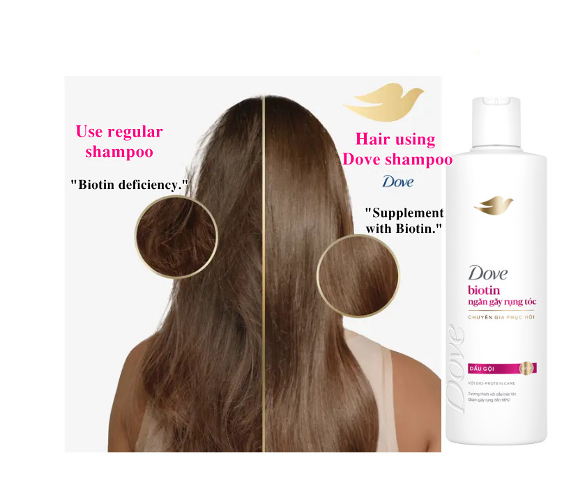 Dove Shampoo Biotin Anti Hair Fall 300g x12 Bottles Suitable for weak and brittle hair 4 5 41